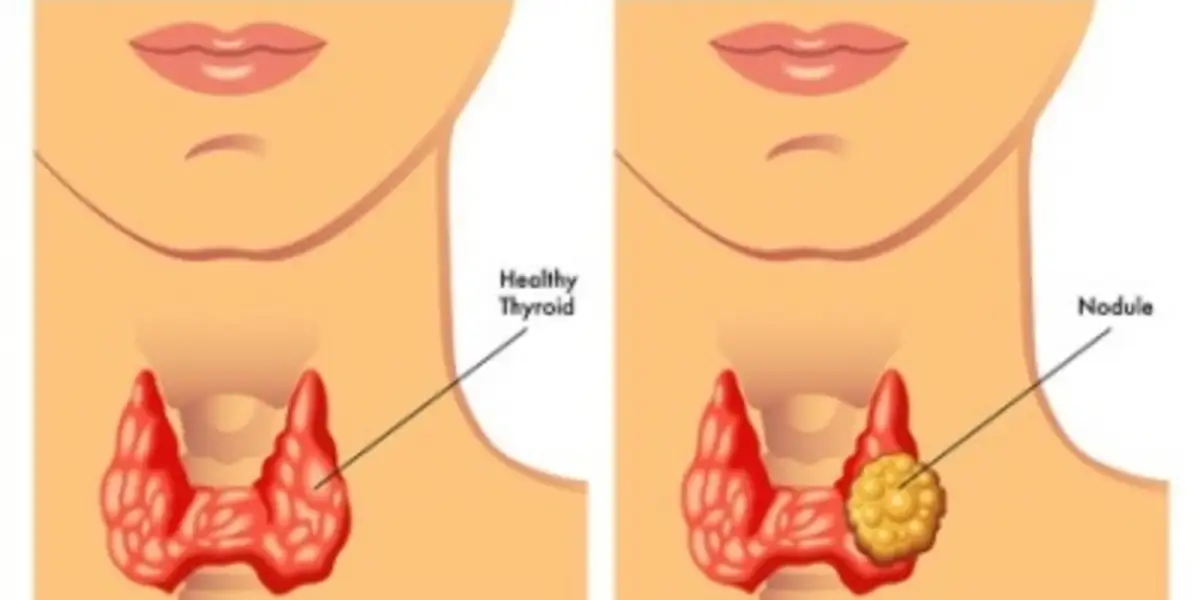 Thyroid-S Online